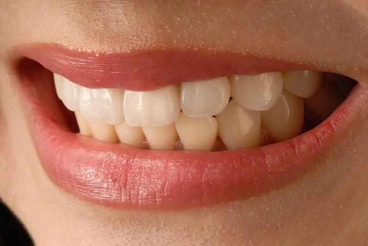标准的牙齿咬合是什么样的?