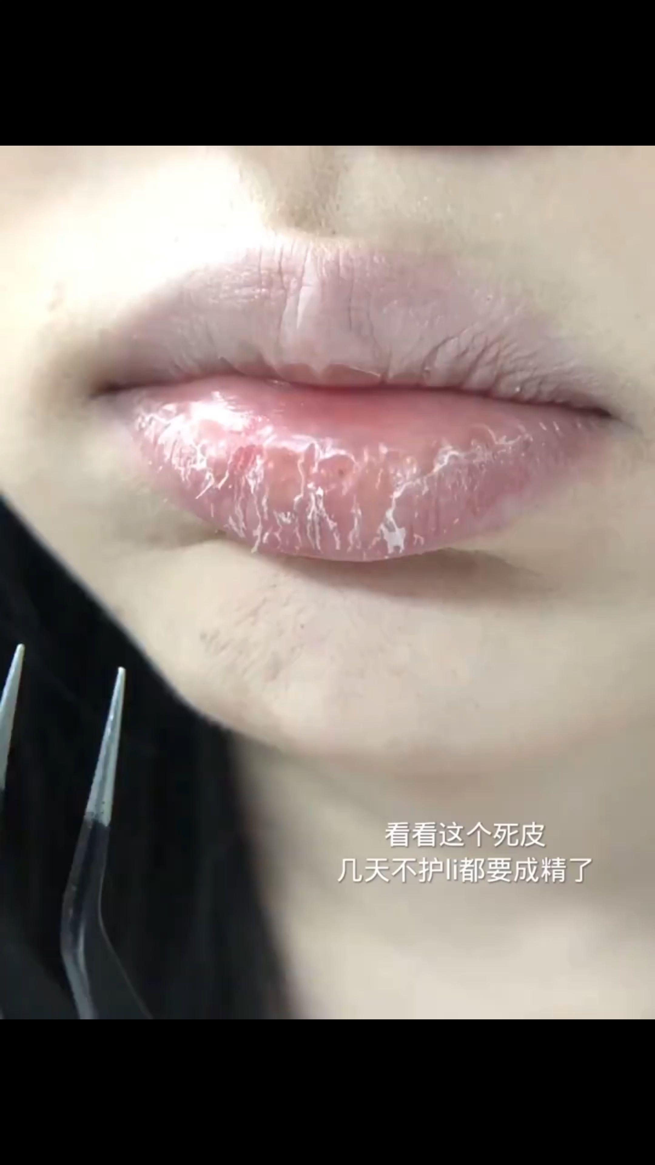 秋冬季嘴巴起皮干燥我用宝肤语唇炎唇膏超好用