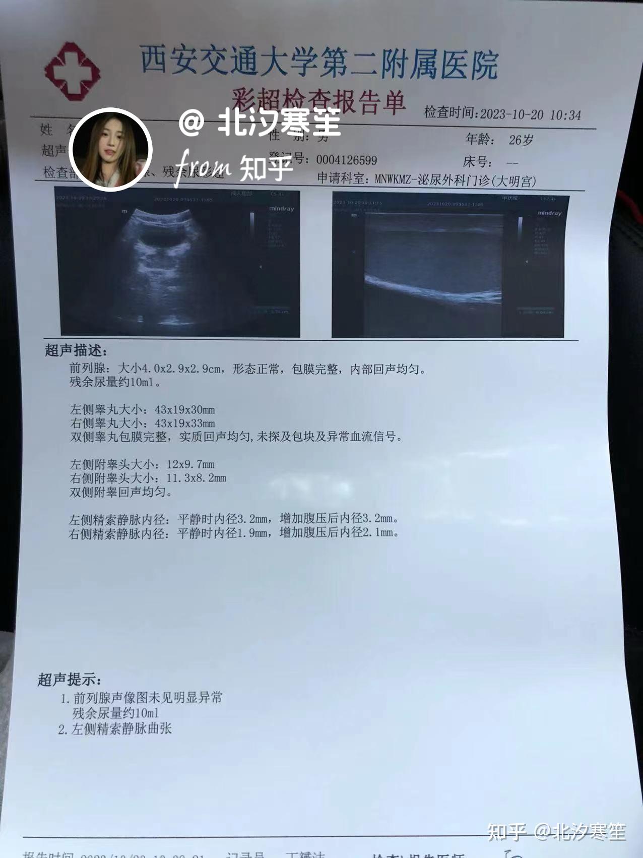 关注问题 67 写回答 登录/注册 静脉曲张 静脉 精索静脉曲张 睾梃