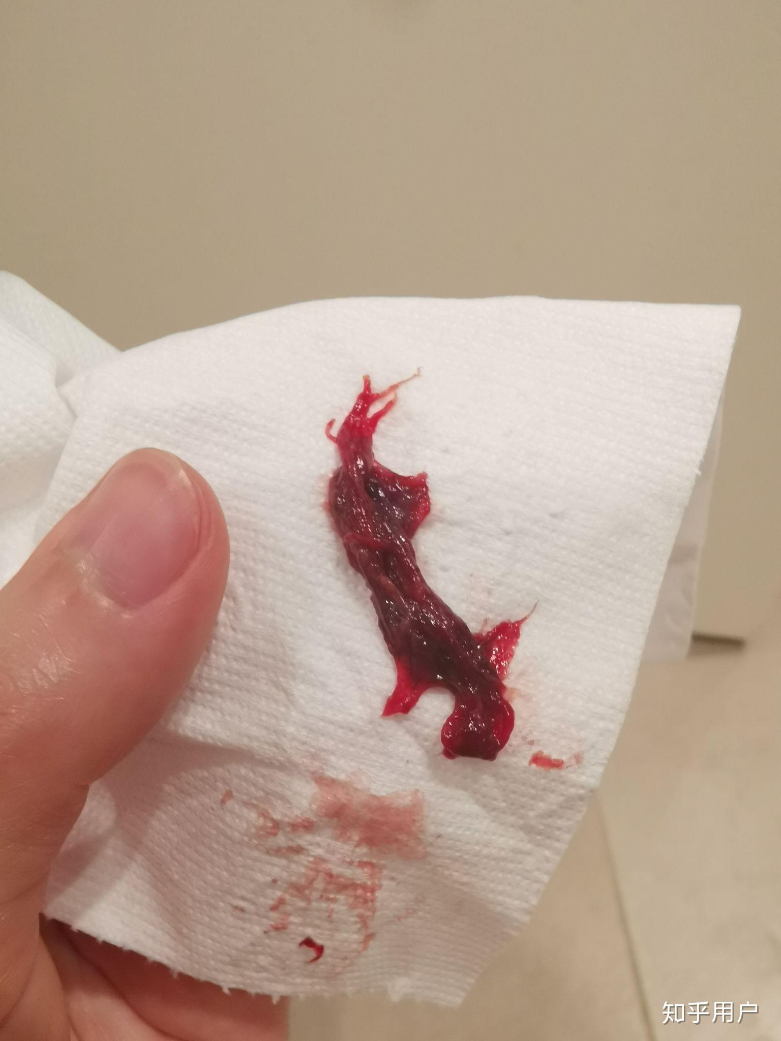 月经期为什么会排出类似小肉块的东西? - 知乎