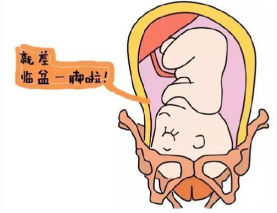 胎儿入盆是什么感觉