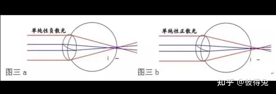 如何科学通俗易懂的讲解散光顺规 逆规和斜轴 以及球柱转换? - 知乎