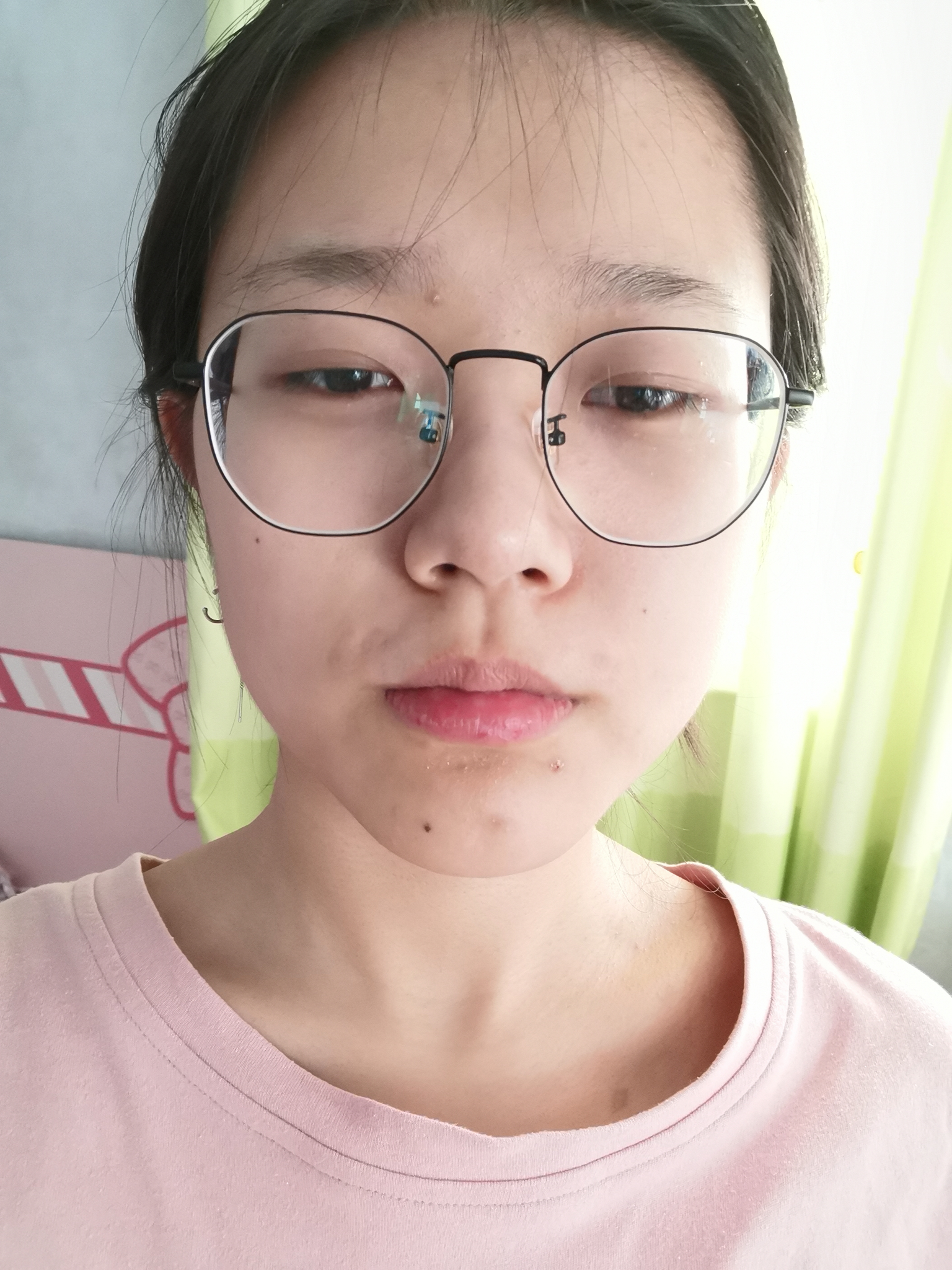 上嘴唇上翘上翻怎么办侧面看起来简直丑哭我