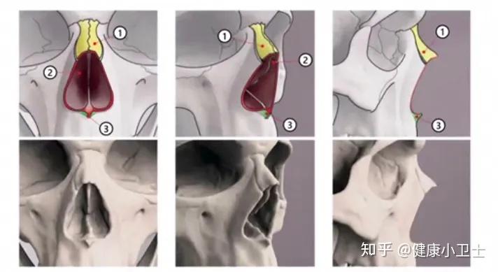 男与女在面部骨骼上有哪些特征? - 知乎