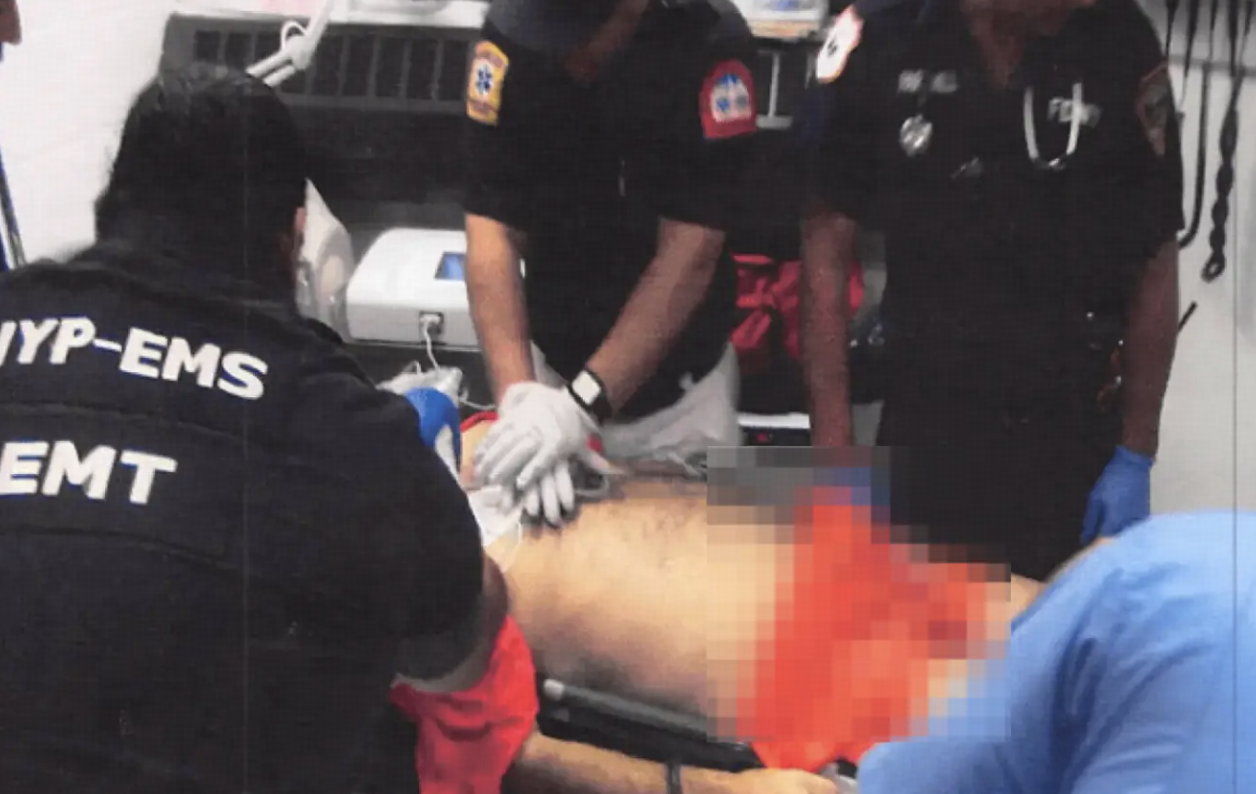 爱泼斯坦「自缢」后照片首度公开，喉骨断裂与脖颈处勒痕明显，这与官方「自缢」结论是否矛盾？