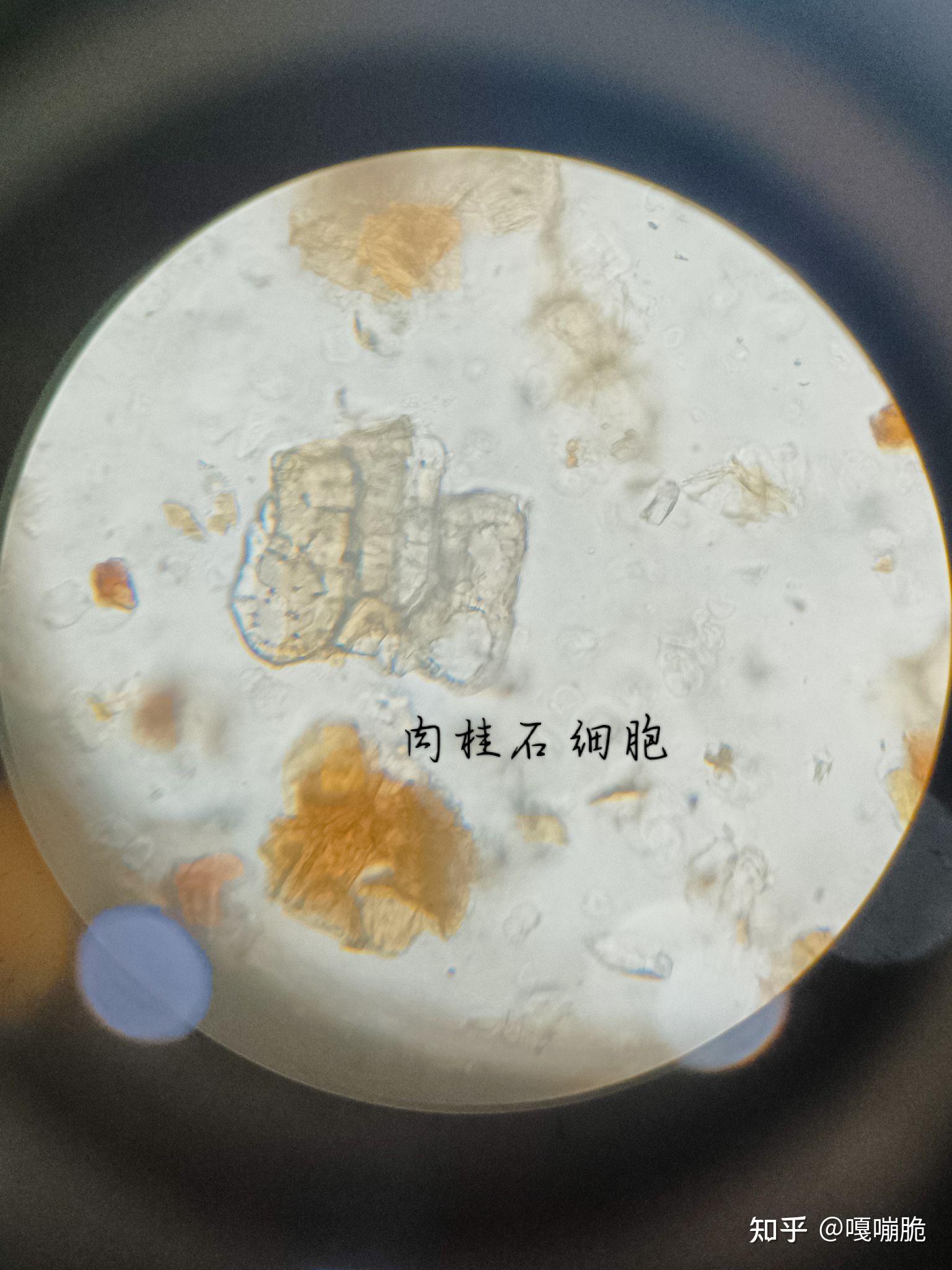 肉桂的显微观察 - 知乎