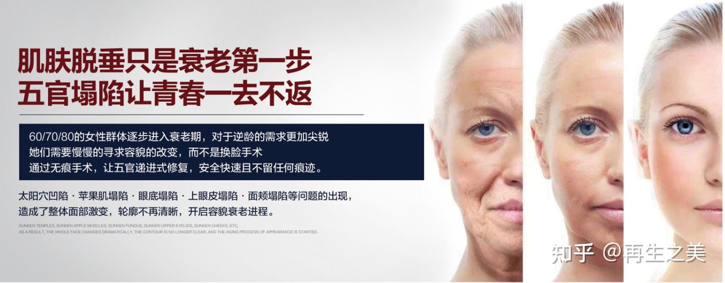 剥离抗衰知识科普 - 知乎