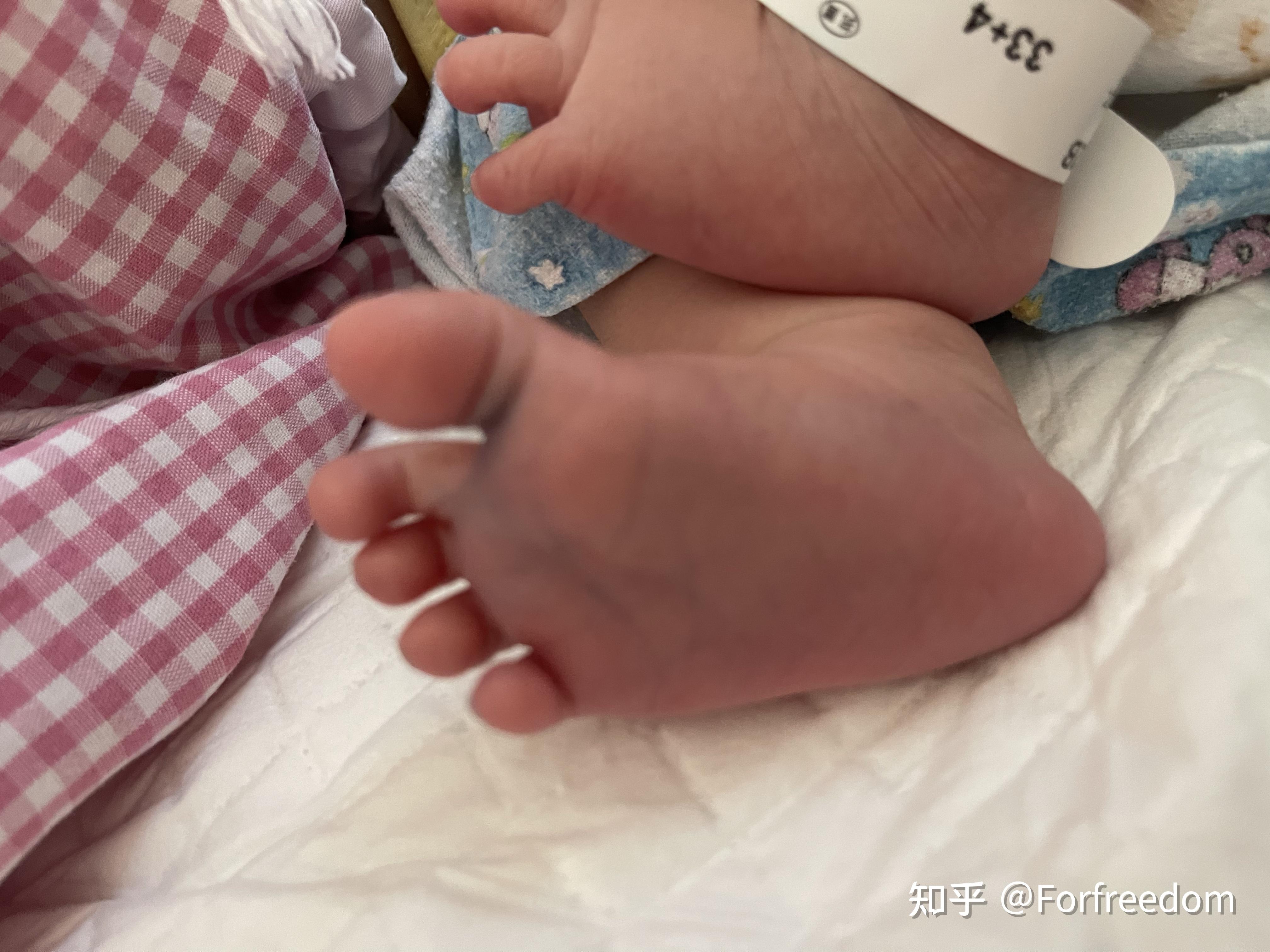 为什么妈妈都喜欢闻孩子的脚丫子?