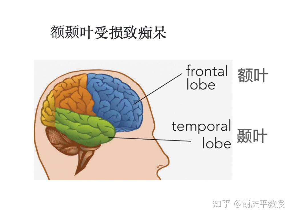 父亲是额颞叶痴呆患者,48岁发生,我需要做什么个人准备来预防自己可能遗传额颞叶痴呆症? - 知乎