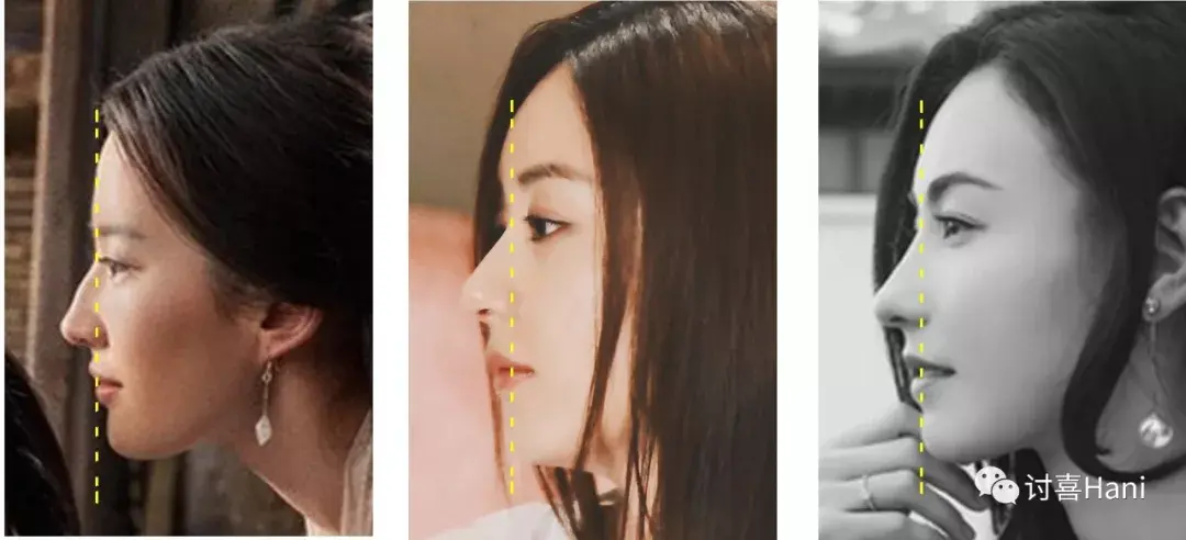 龅牙凸嘴怎么改善侧脸? - 知乎