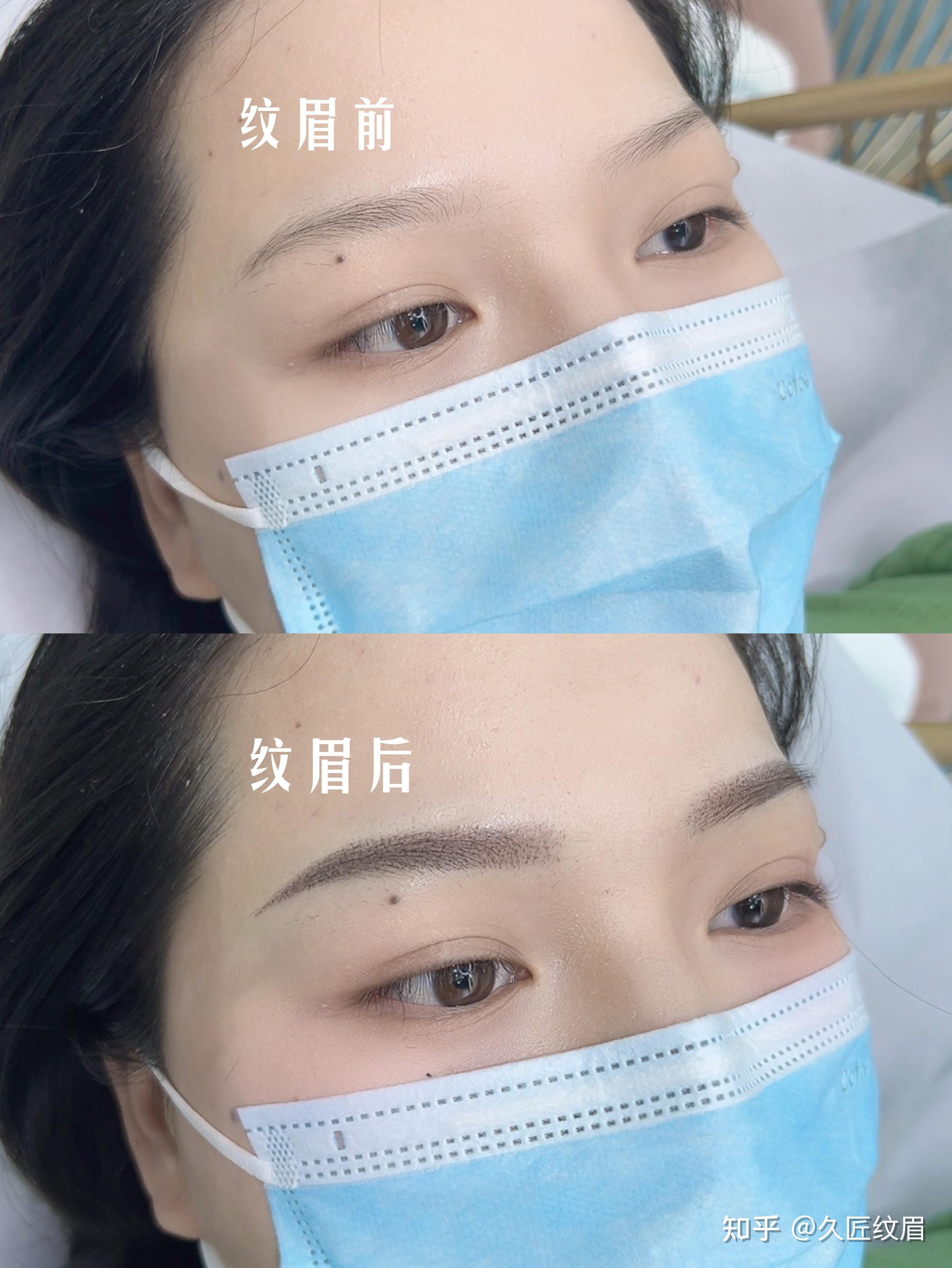 韩式半永久纹眉的恢复过程是怎样的? - 知乎