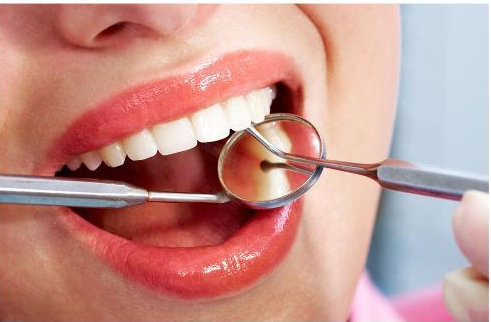 第一次洗牙什么感觉?