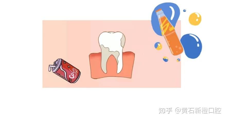 牙齿脱矿?哪些原因会导致牙齿脱矿?牙齿脱矿怎么办? - 知乎