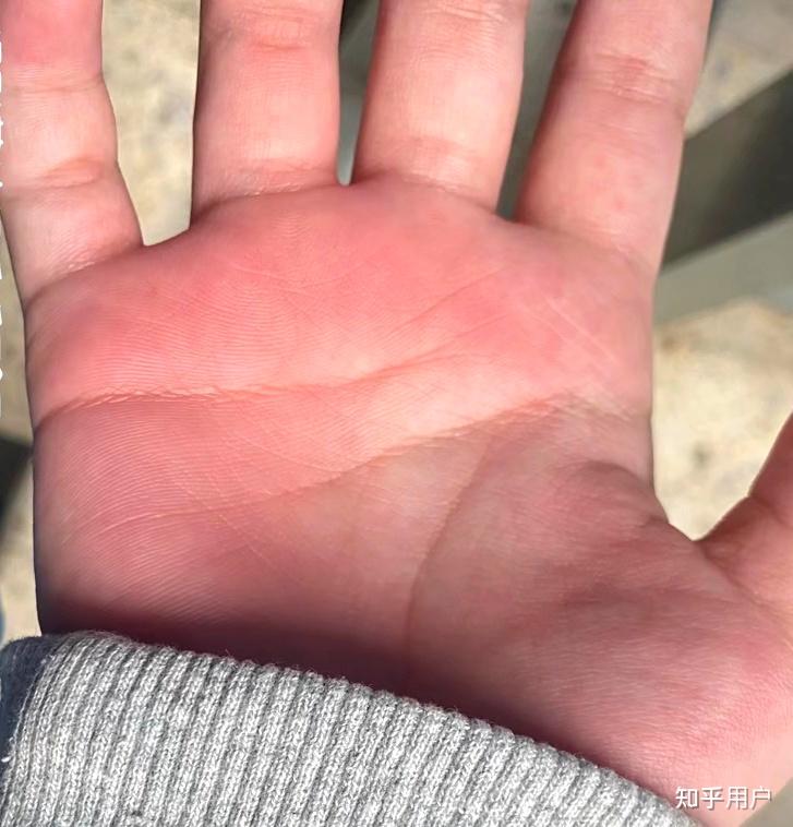 被打手心是种怎样的体验?