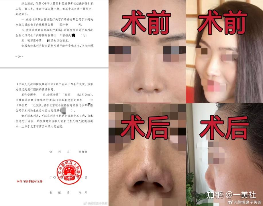 起底俊泰系医美乱象:违规聘用未备案医师 鼻整形失败致畸形(图11)