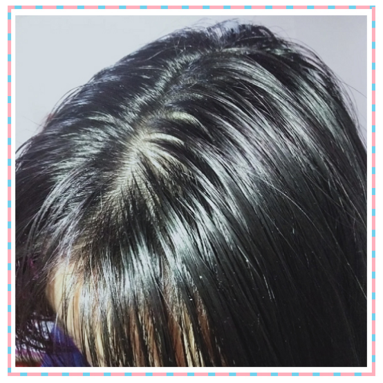 油性发质,而且掉头发,一般一天洗一次头发,用什么洗发水比较好?