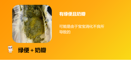 别焦虑！60+宝宝便便图，教你准确识“便” - 知乎
