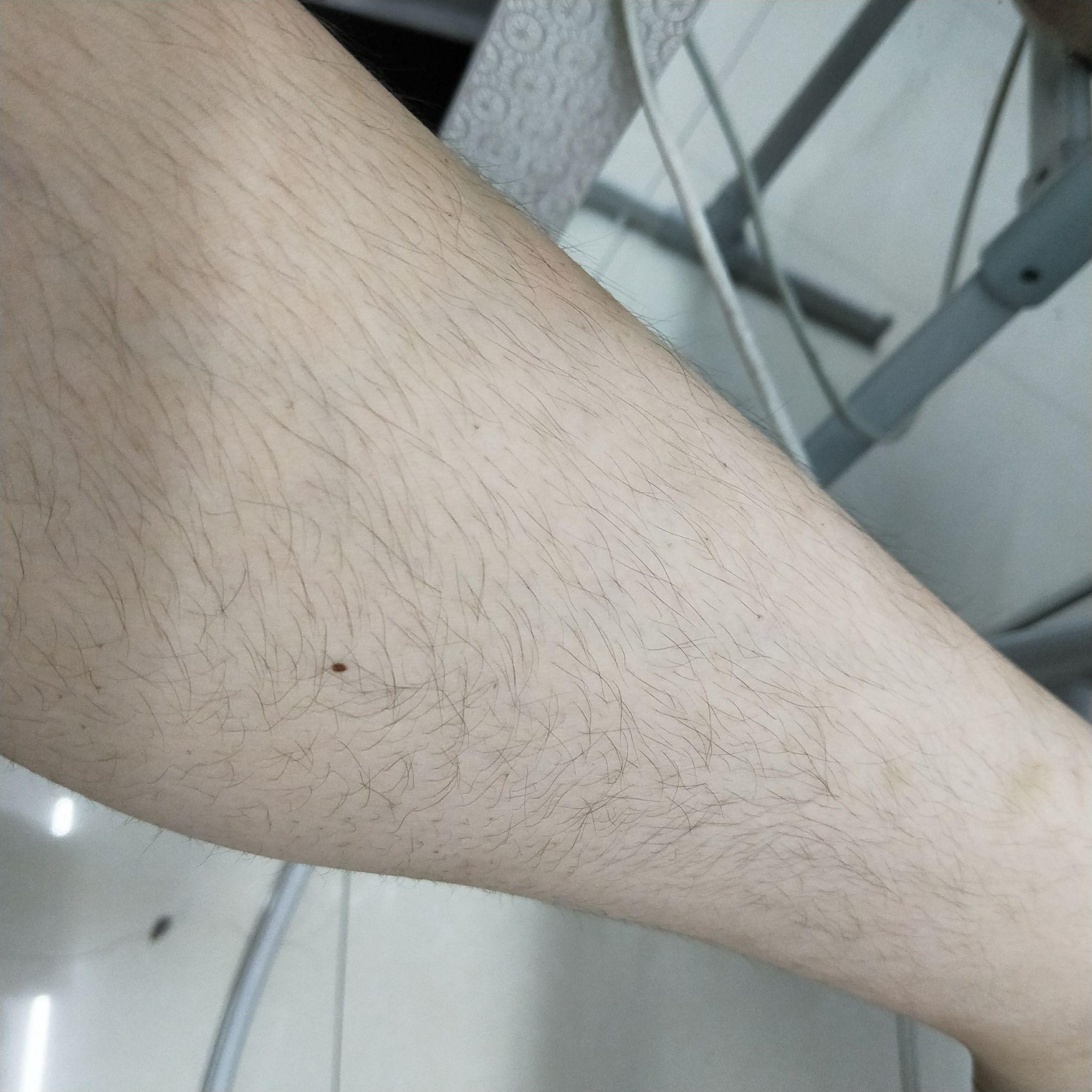 女生腿毛旺盛是怎样的人生体验