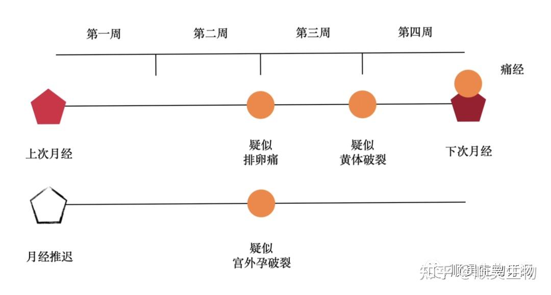 女生看过来→没来月经但是肚子痛?可能是“卵疼”…… - 知乎
