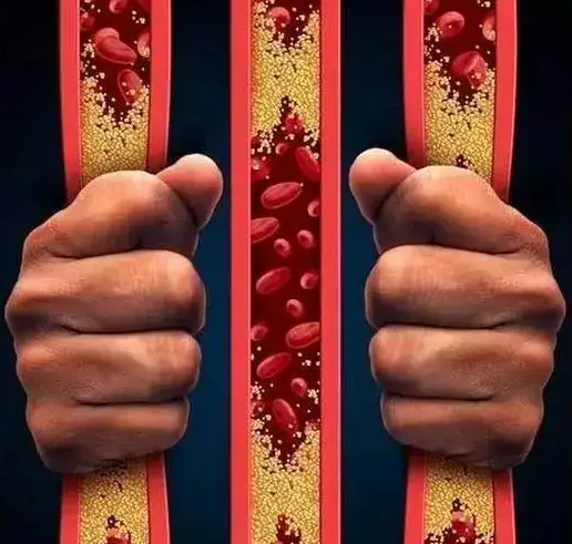 气滞血瘀与气血瘀滞 - 知乎