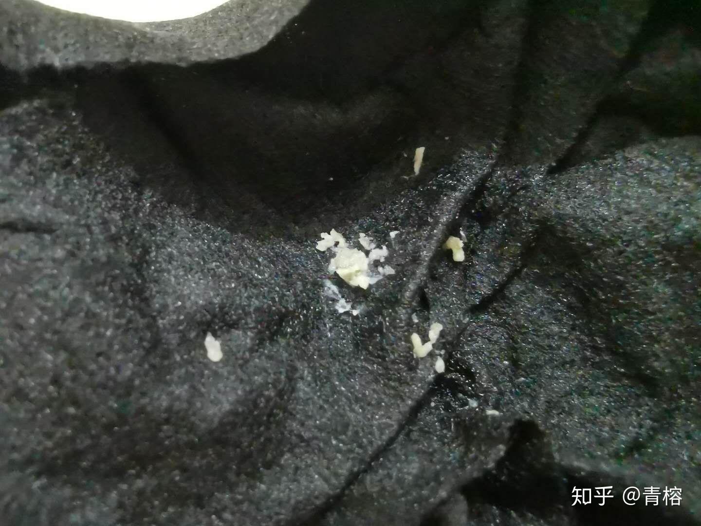 毛孔长摸起来刺刺的拔出来后一条白白硬硬的是什么东西呀