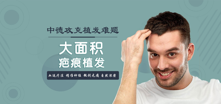 疤痕植发难吗?如何保障成活率? - 知乎