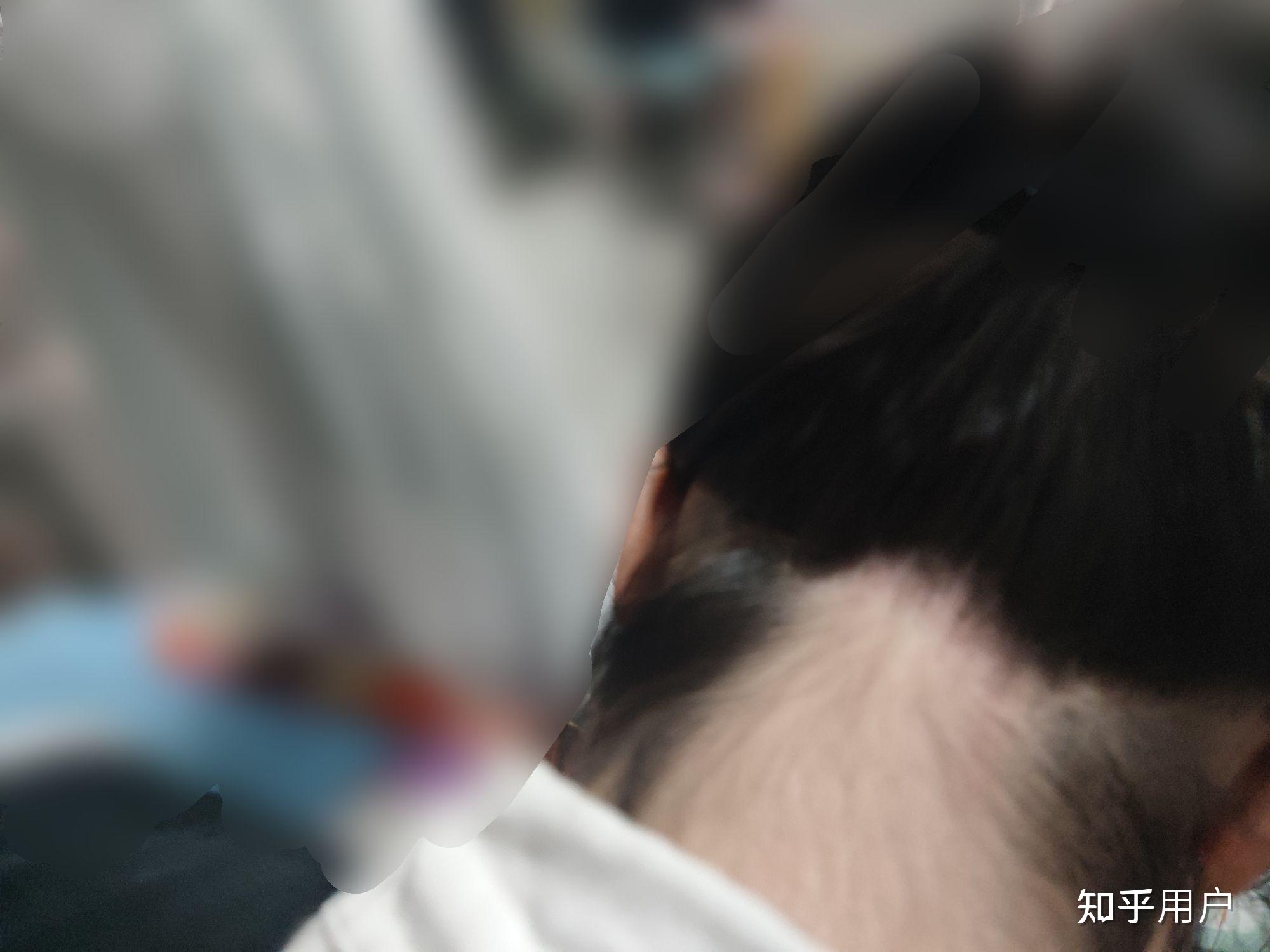 脖子后面长头发了怎么办? - 知乎