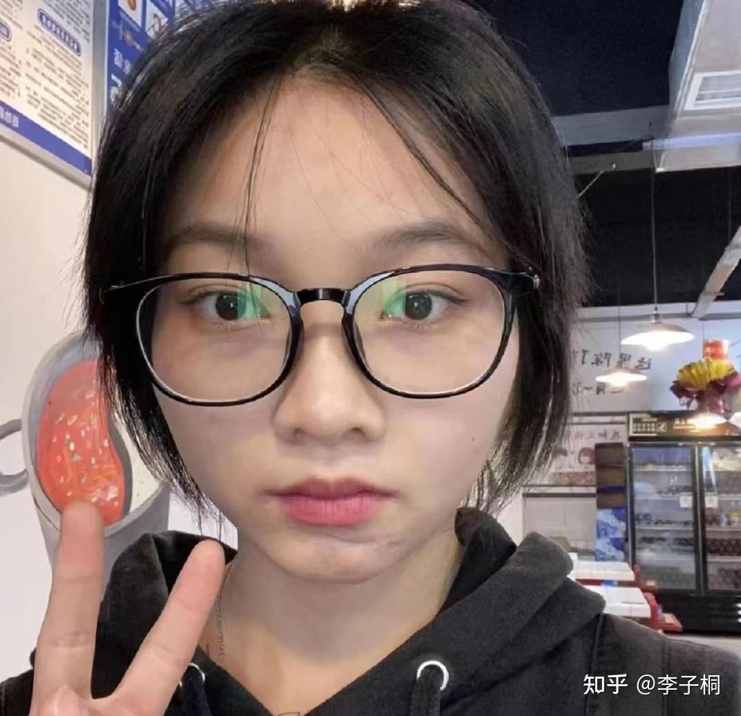 蓝莓叶黄素酯片真的有用吗? - 知乎