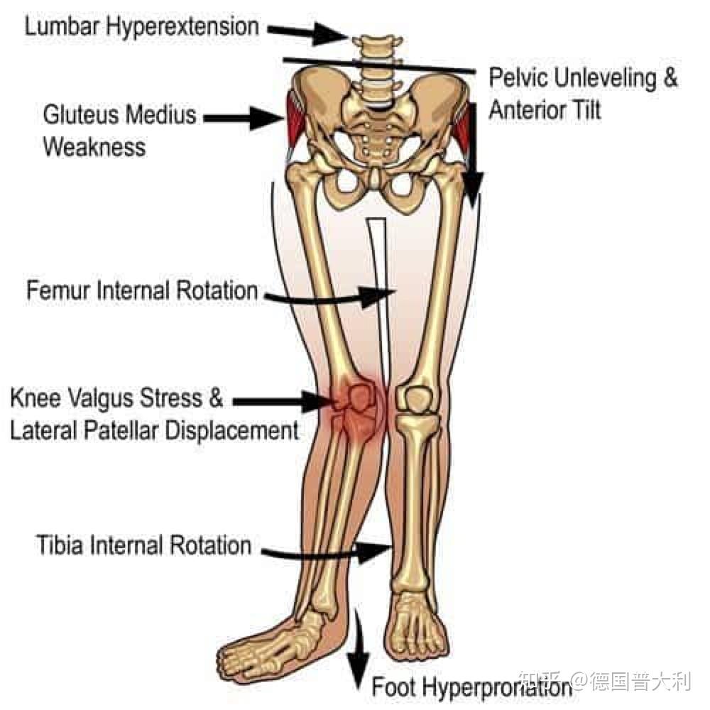 gluteusmedius图片