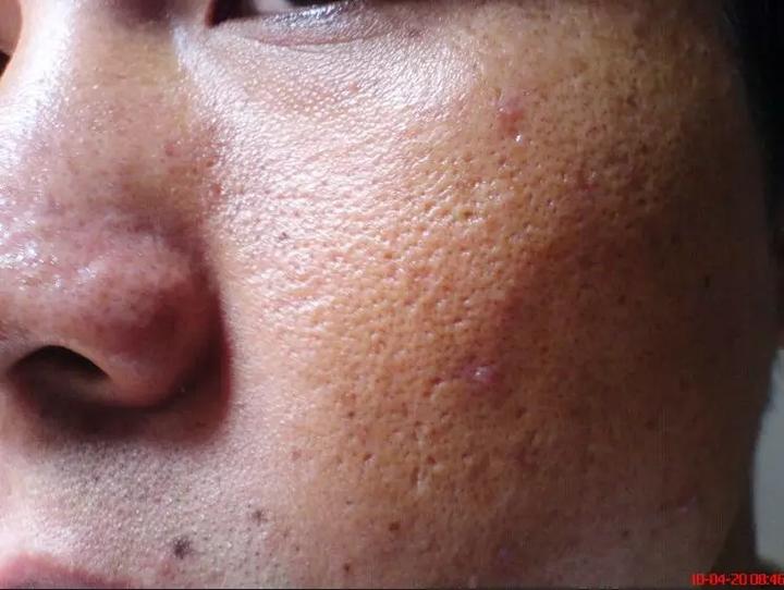 你是油性皮肤?还是干性皮肤?