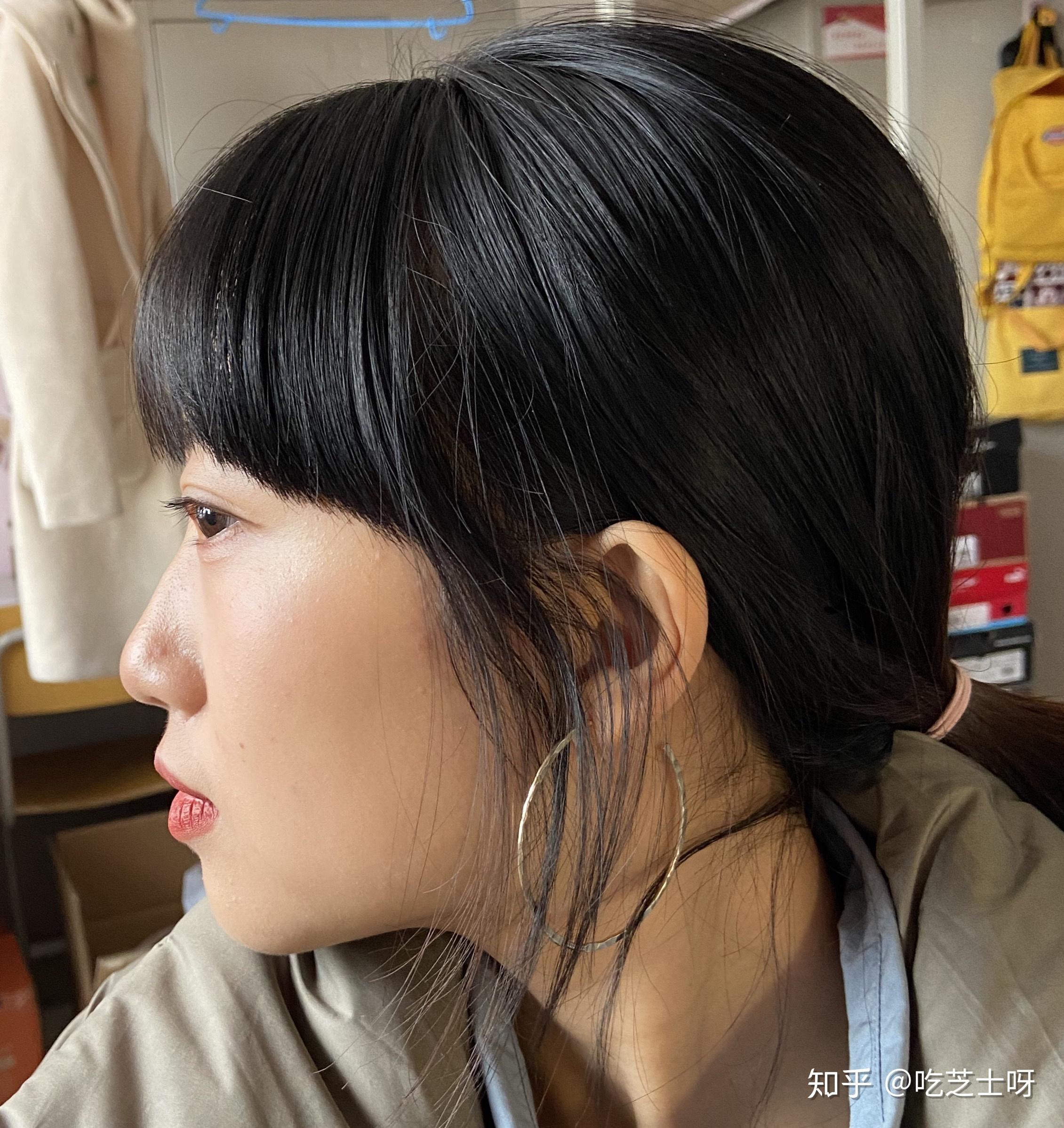 侧面看眼睛非常突眉骨低和鼻子连接不起来是怎么回事