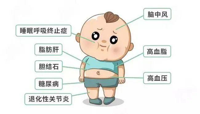 儿童肥胖症有哪些危害向海燕专家问您解答