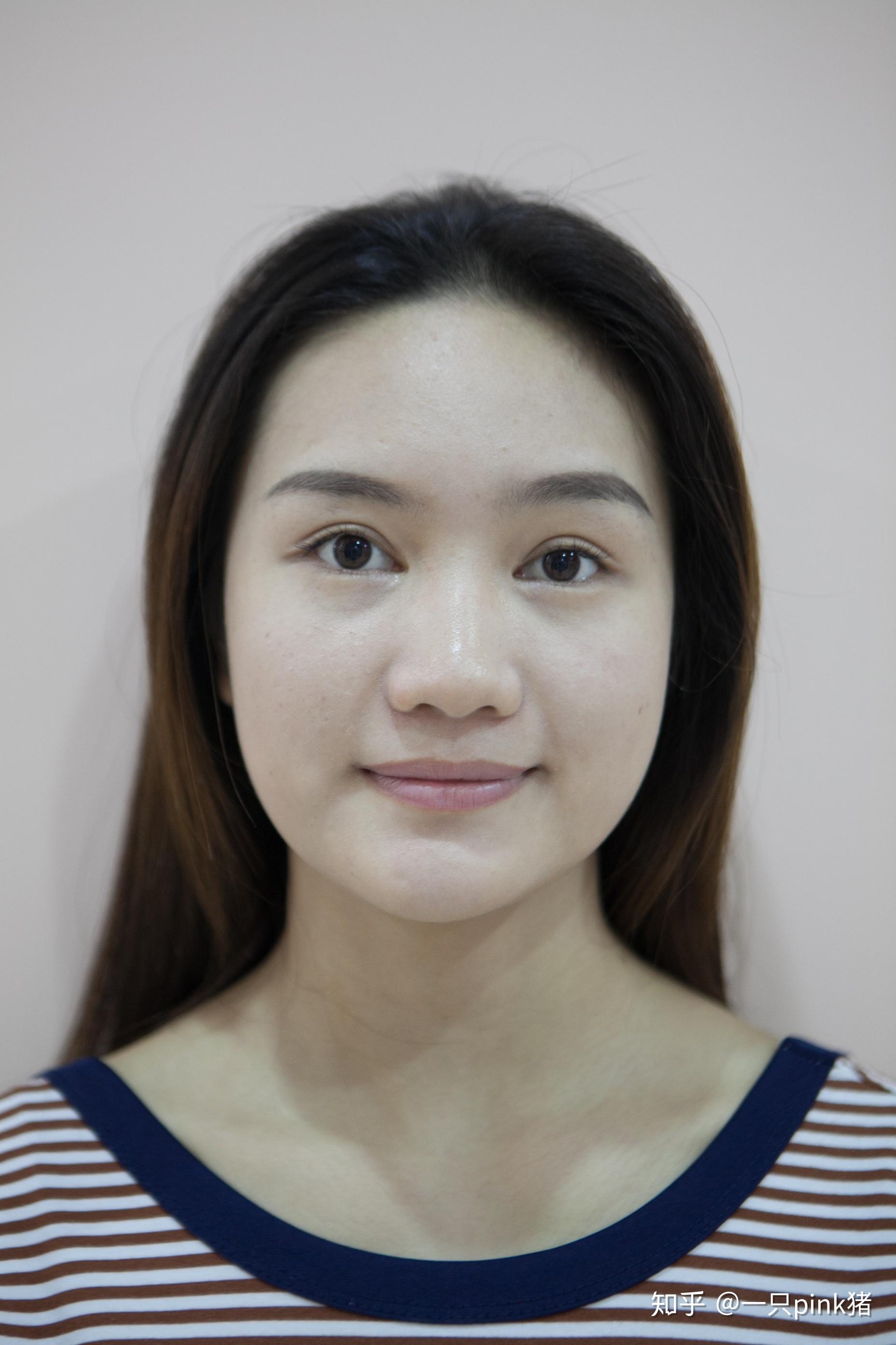 拥有宽鼻翼大鼻头是怎样一种体验? - 知乎