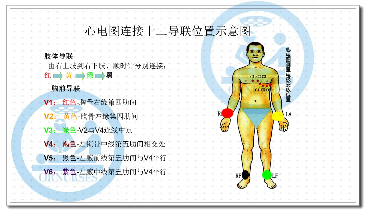 请问一下女性去医院做心电图检查时穿了这种连衣裙和连裤袜需要先提前