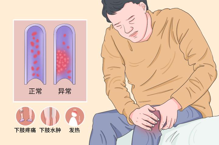 警惕血管中的