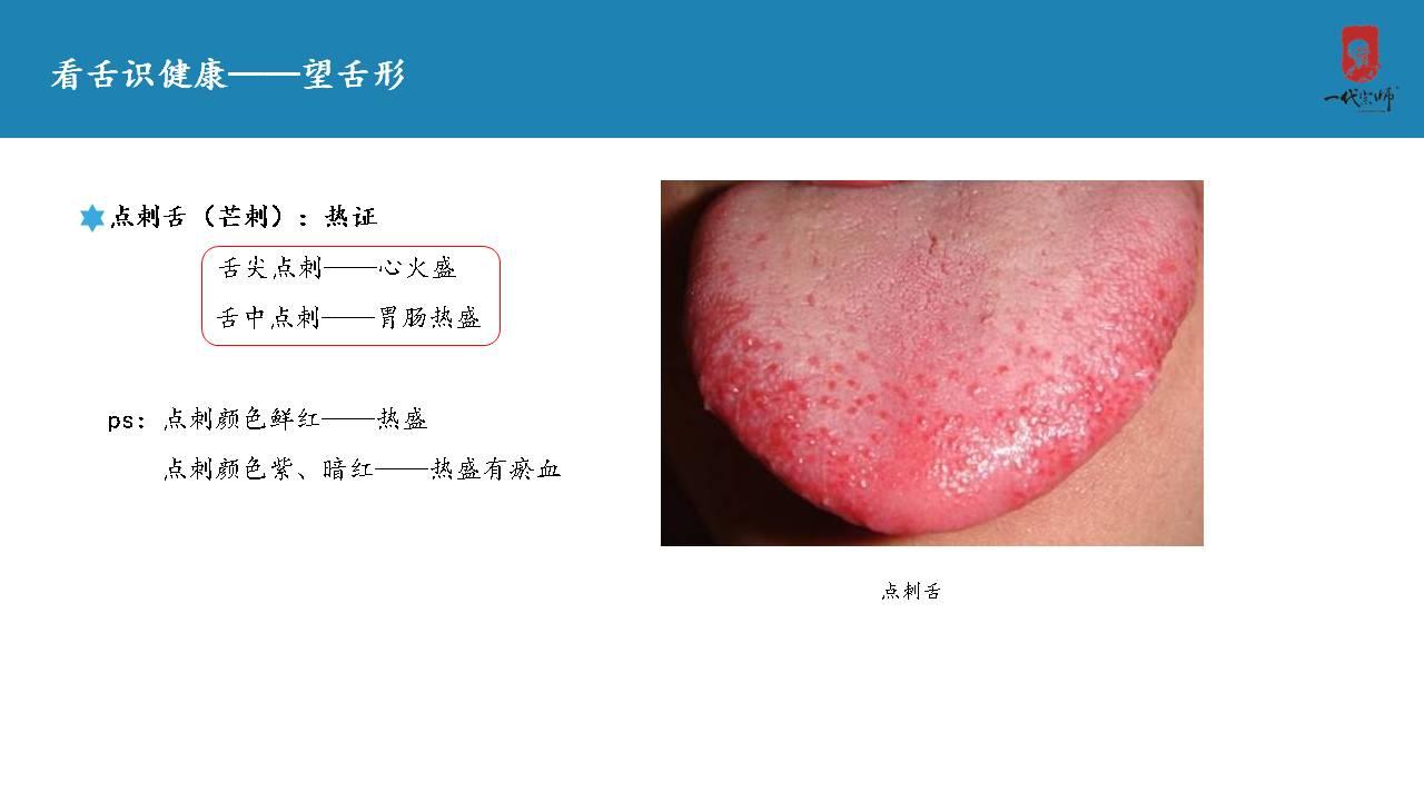 正常的舌苔是怎样的? - 知乎