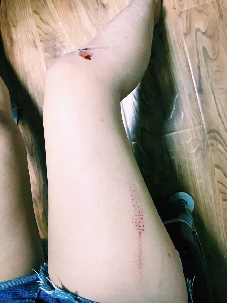 玩滑板摔倒是一种怎样的体验