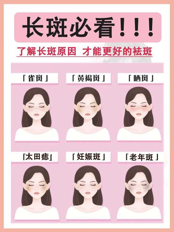 斑的形成原因及分类 知乎