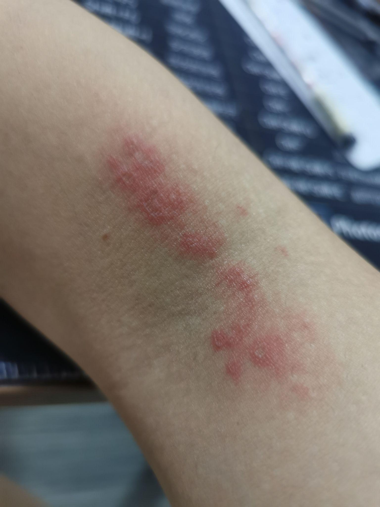 蜘蛛撒尿是什么样子的?