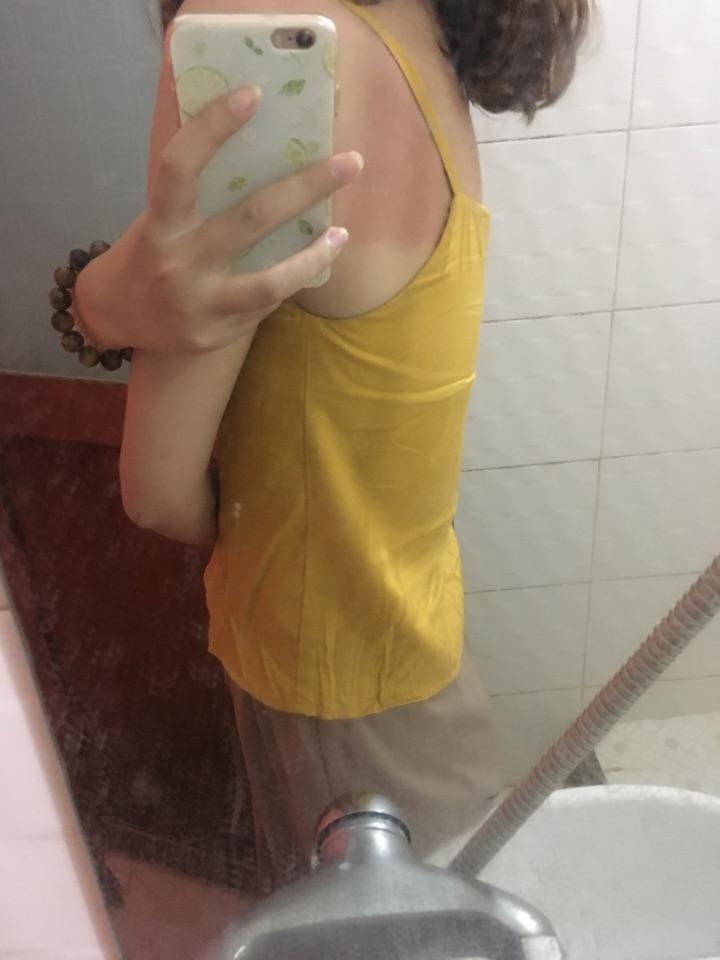 今天看知乎一个答主说用鱼肝油乳混合维生素c注射液涂抹身上请问专业