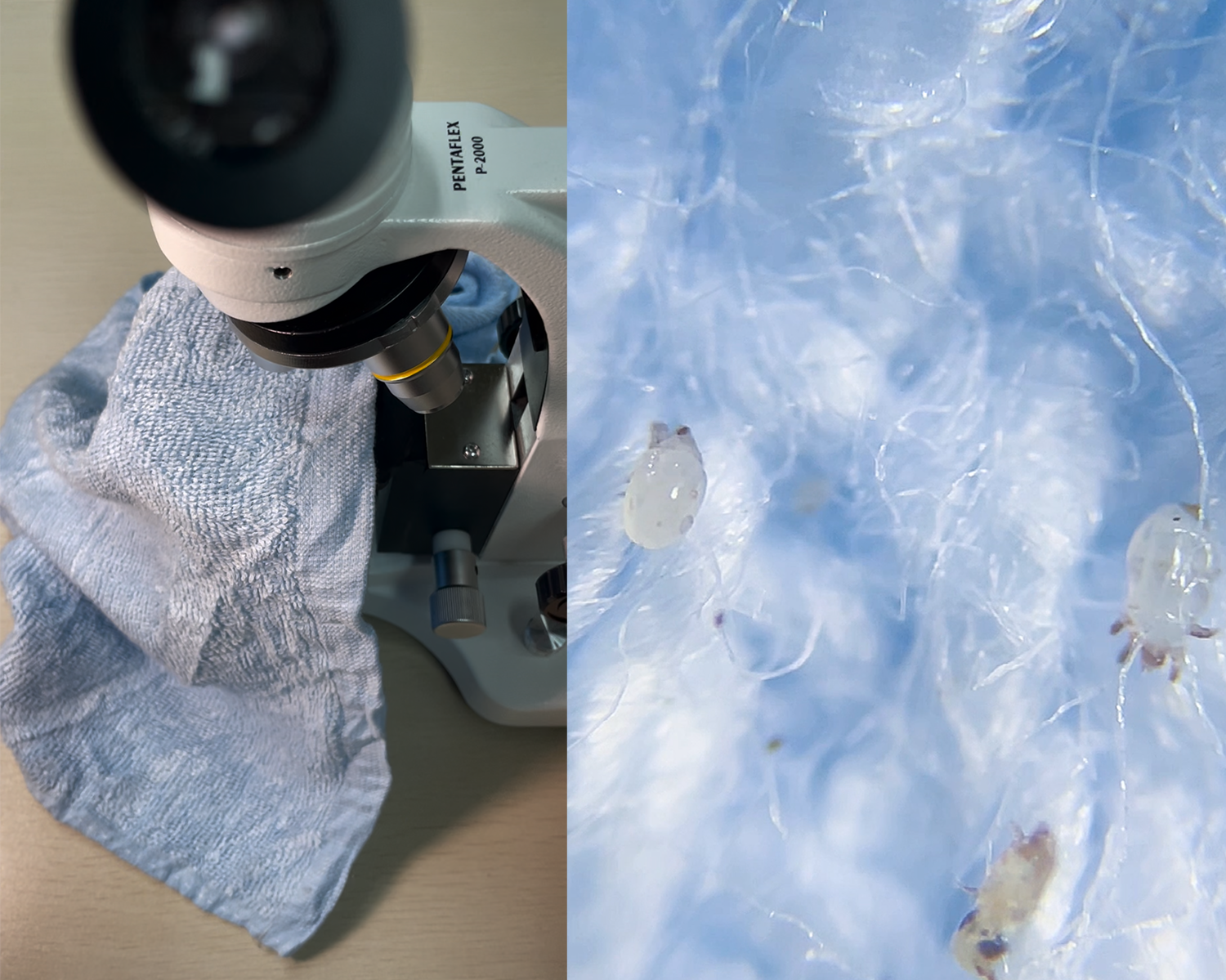 请问被子里的螨虫是怎么长出来的啊?好恶心的赶脚! - 知乎