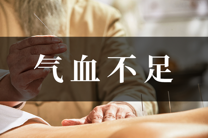 气血不足怎么办?用中医这样调... - 知乎