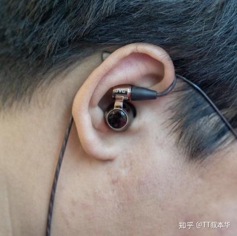 什么是后绕式耳机?