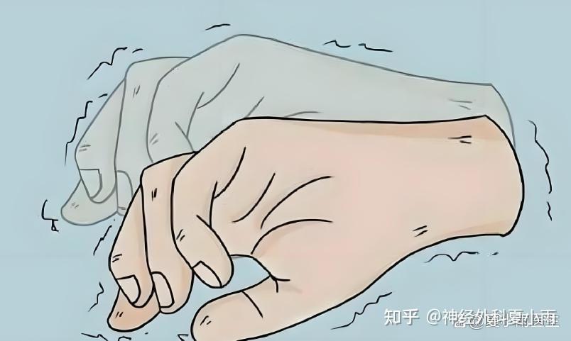 帕金森病患者手抖严重影响生活，家属该如何照顾？ - 知乎