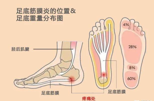 脚后跟结构图片