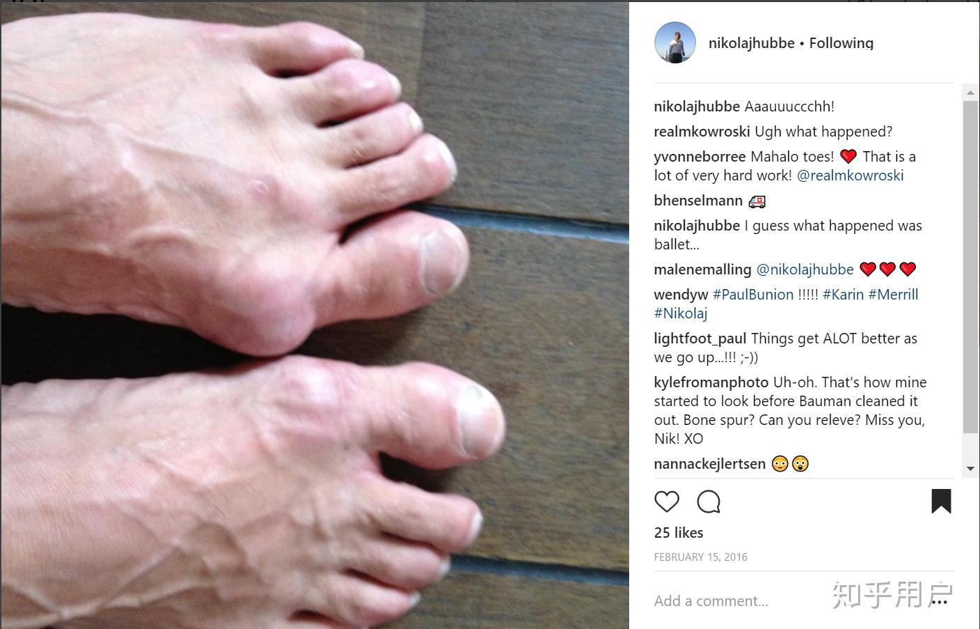 女孩学习芭蕾会不会让脚变形一般是多大年龄可以开始训练足尖