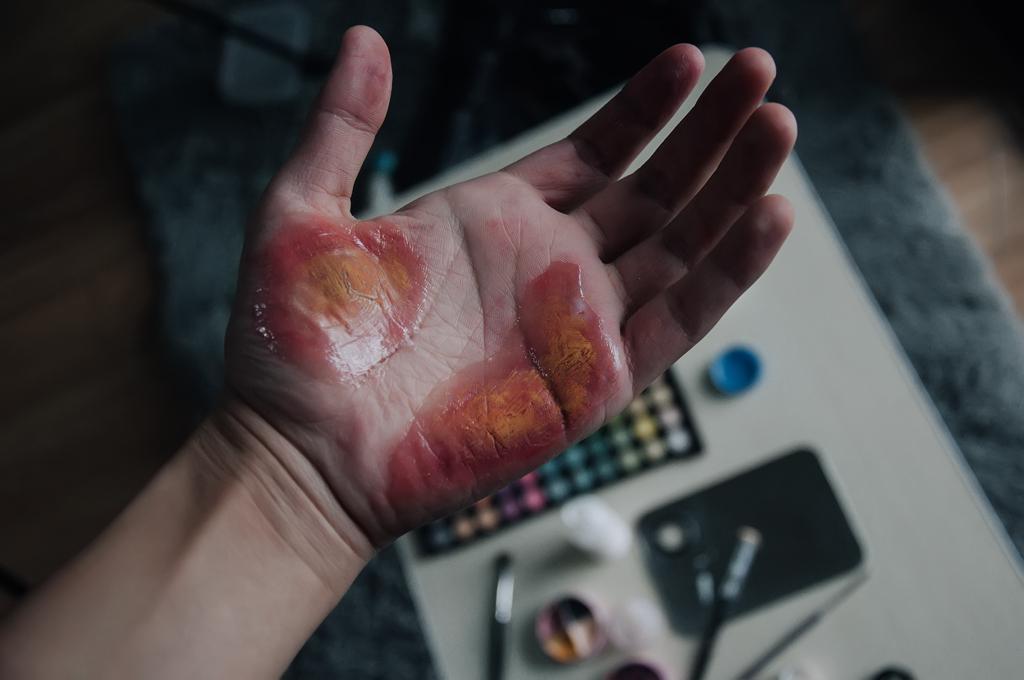 需要什么样的药物/化学物质能在皮肤上弄出这样的泡? - 知乎