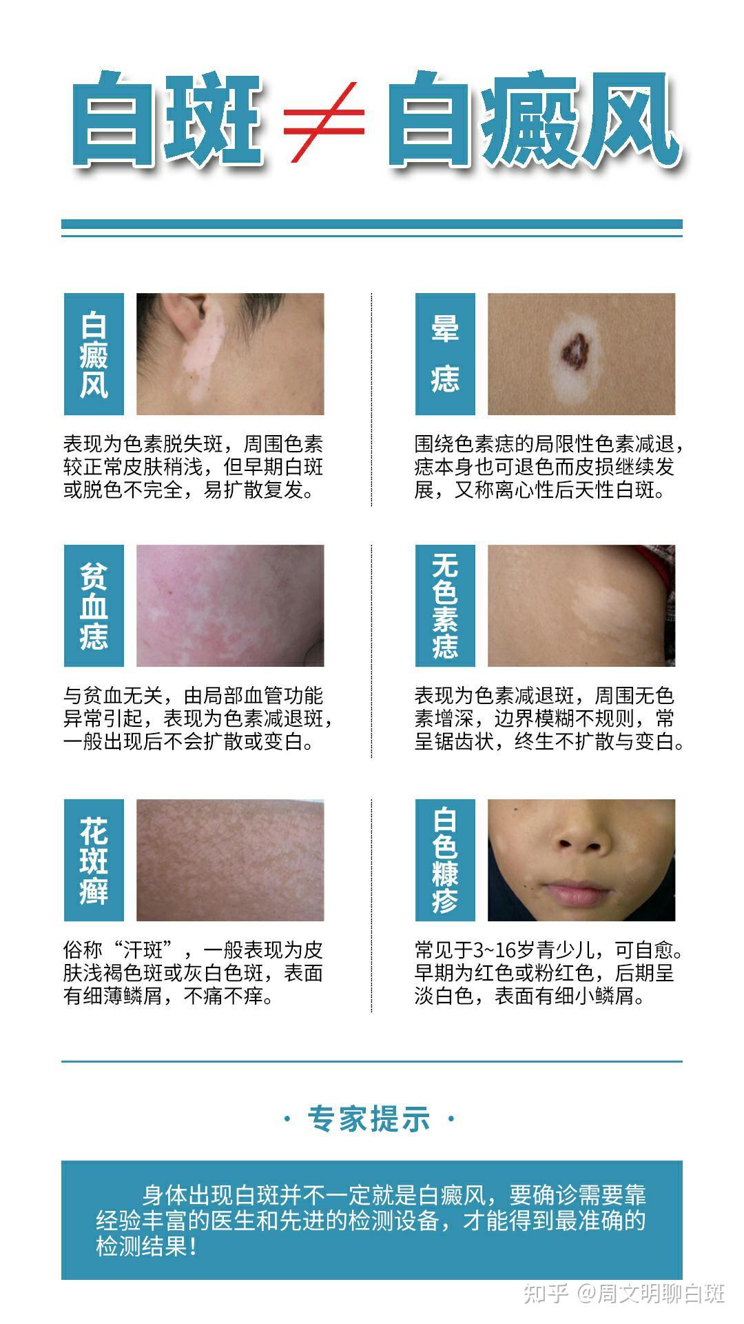 常见皮肤科皮肤病损的形态和分布_医疗科普_百康医疗