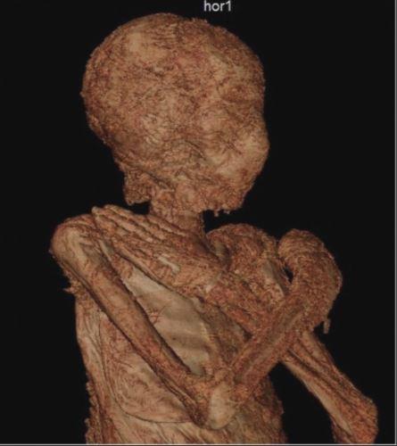 世界首次发现怀孕的木乃伊