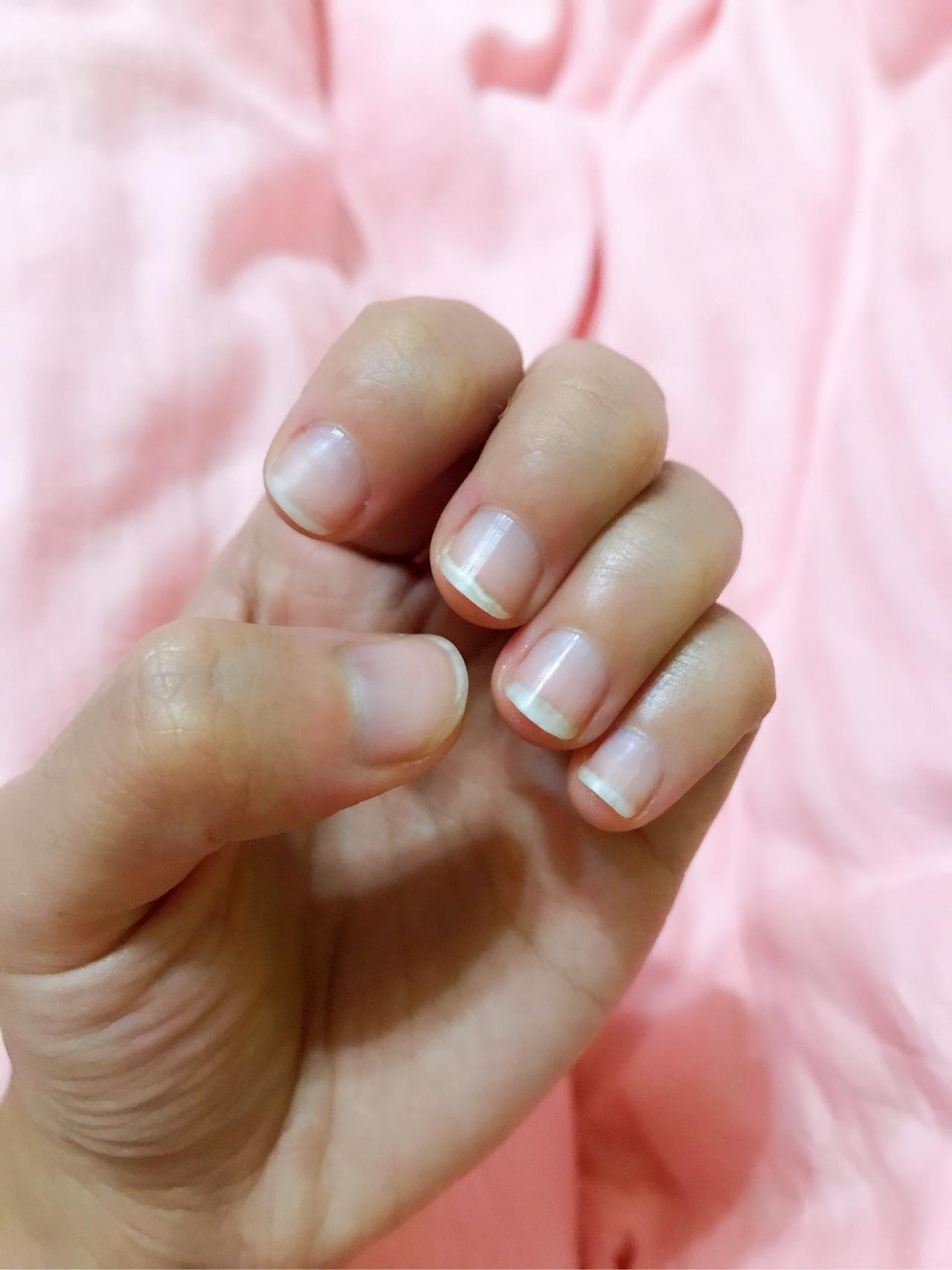 手指甲被咬的超级短怎么办? - 知乎